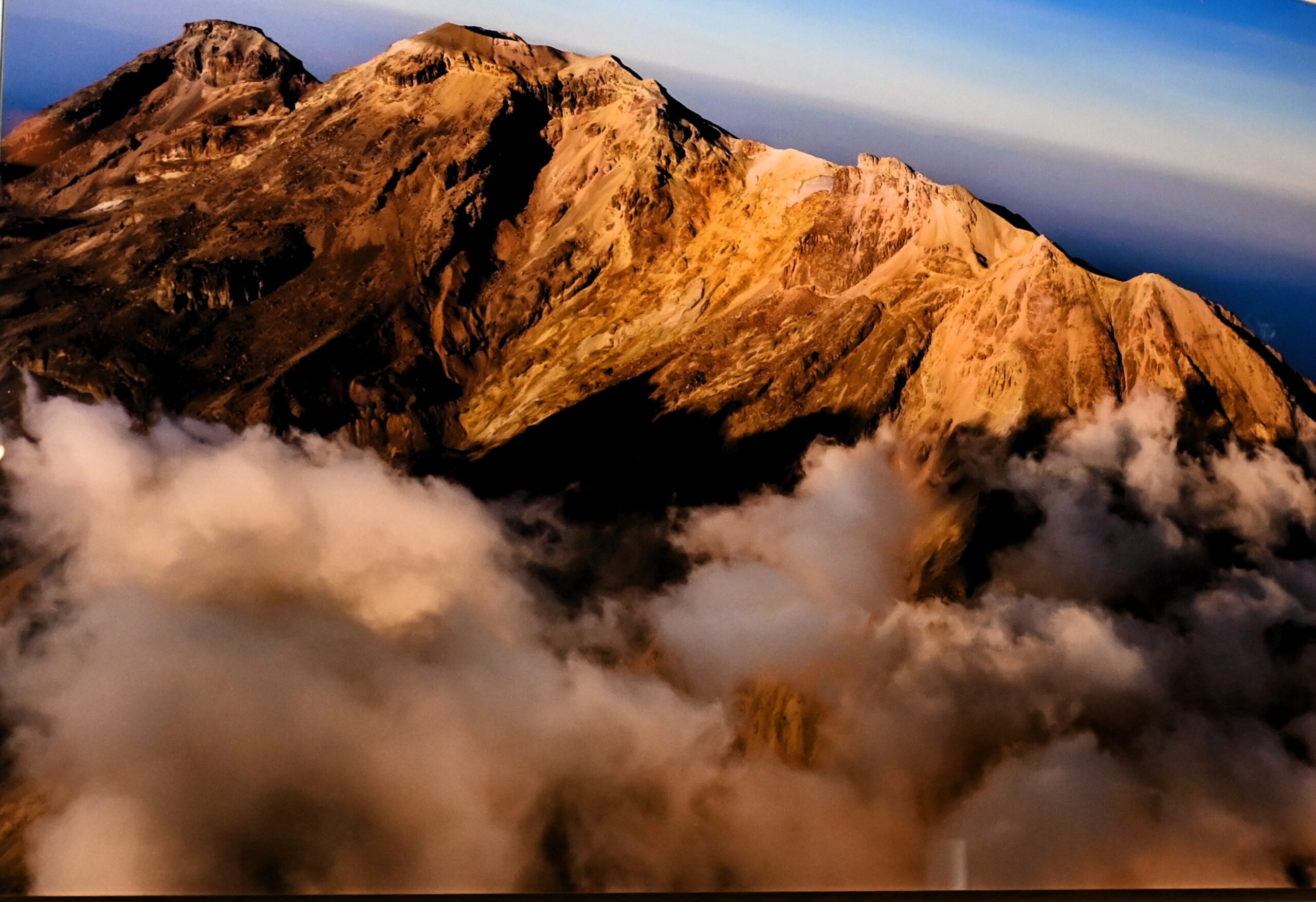 Colectivo de mujeres busca sensibilizar sobre el Cáncer con expo fotográfica