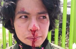 Ciclista golpeada en Cuemanco